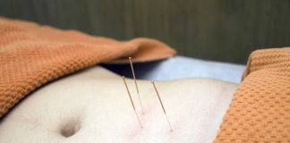 acupuncture médecine douce Ra Santé
